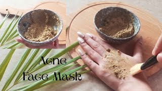 How to remove pimple | How to get rid of pimple | Acne face mask | DIY Face mask for acne| DIY