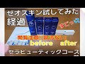 ゼオスキン セラピューティック期間 経過報告 #ゼオスキン #美肌 #スキンケア #シミ