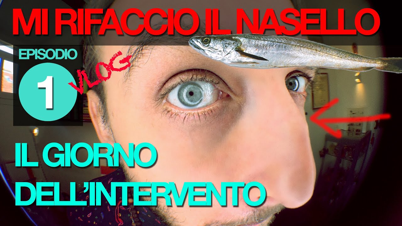 RINOSETTOPLASTICA CON TITO MARIANETTI - la mia esperienza VLOG - EPISODIO 1