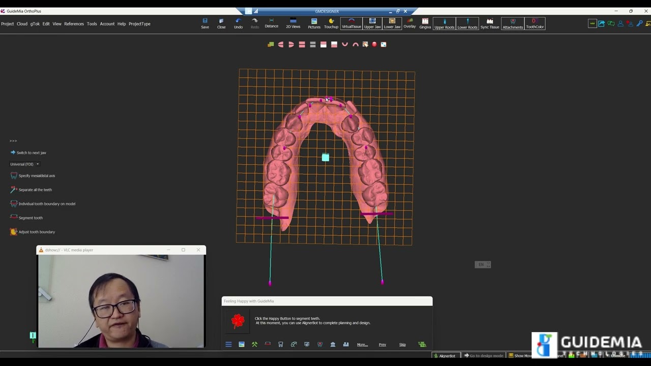 GuideMia OrthoPlus training 3