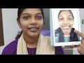 FACEMAKEOVER SURGERY - Jaw Surgery | Nose Job Transformation Before And After - Dr.Sunil Richardson