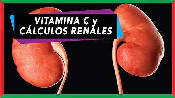 ¿Puede la vitamina C provocar cálculos renales?