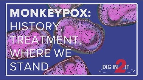 Monkeypox in America: How did we get here and what’s next? | Dig In 2 It