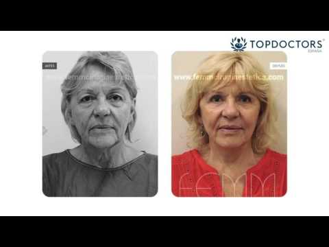 Vídeo: Totes Pròpies: Estrelles De Més De 50 Anys Que No Es Van Remodelar La Cara