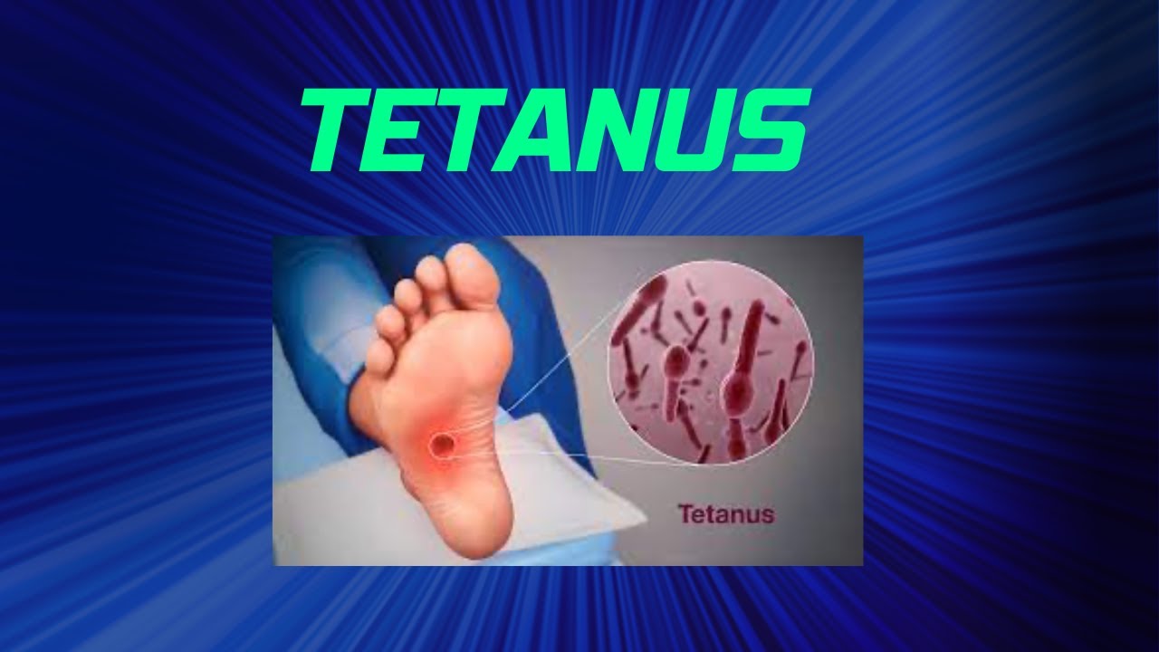 Tetanus - YouTube