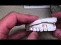 Clear Aligner - Invisible Orthodontic Retainer to Move Teeth