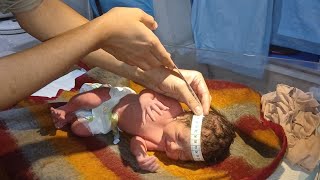 Newborn Baby Initial Assessment | Checking Sucking & Grasp Reflexes, Head & Chest Circumference