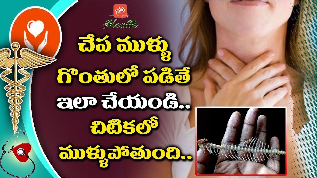 How To Remove When Fish Bone Stuck In Your Throat Health benefits Of