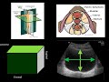 Introduction to renal ultrasound
