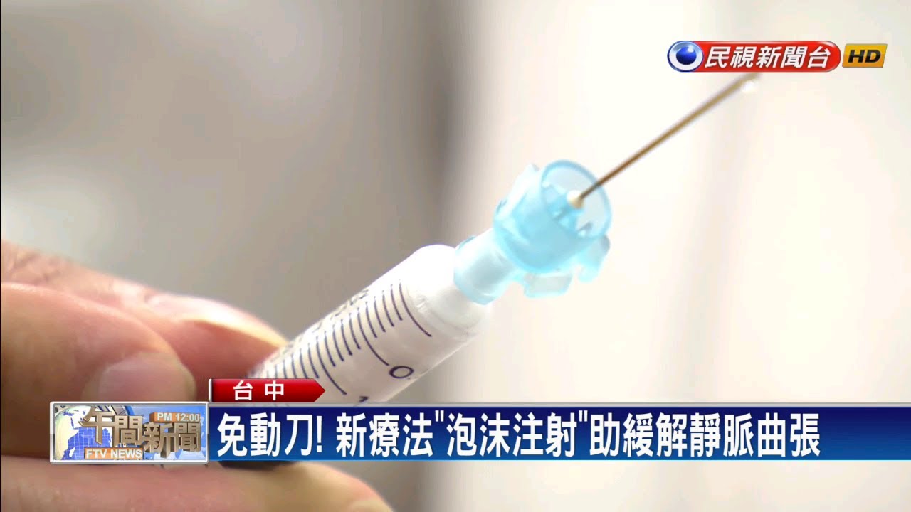 靜脈曲張誤診 烏腳病 婦人險遭截肢 民視新聞網