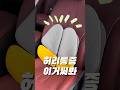 병원가야지 이런걸로 해결되냐?