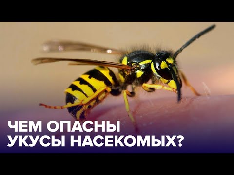 Первая помощь при УКУСАХ НАСЕКОМЫХ – как правильно ее оказывать?