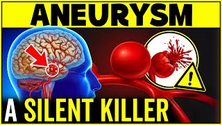 Aneurysm: A Silent Killer | What Is It, How Does It Happen, And How To Prevent It?