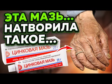 Все секреты раскрыты! Цинковая мазь запускает необратимые последствия для...