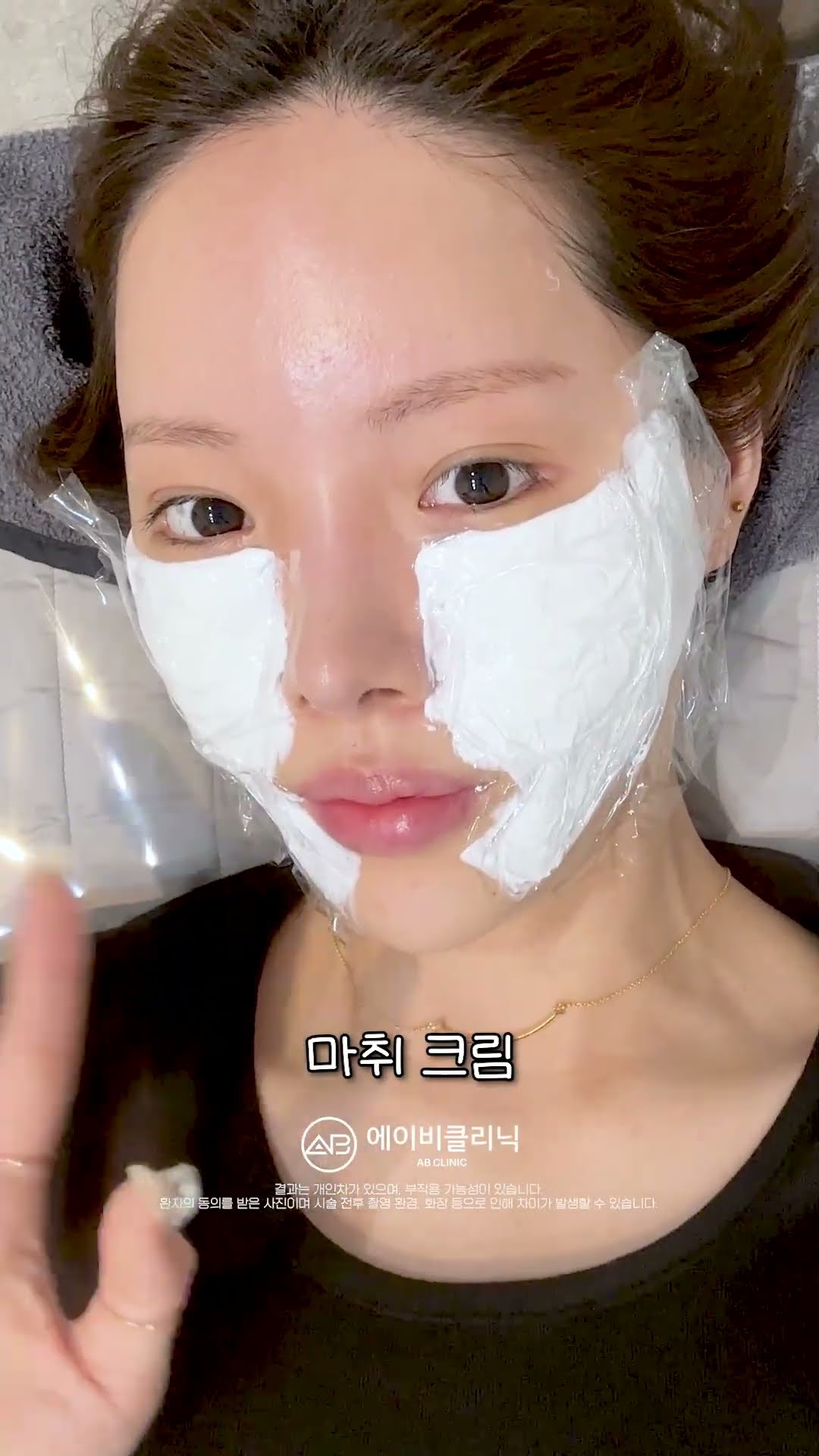 리쥬란힐러 후기