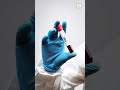 CRIB Blood Group Explained | Rarest Blood Group Discovery in the World