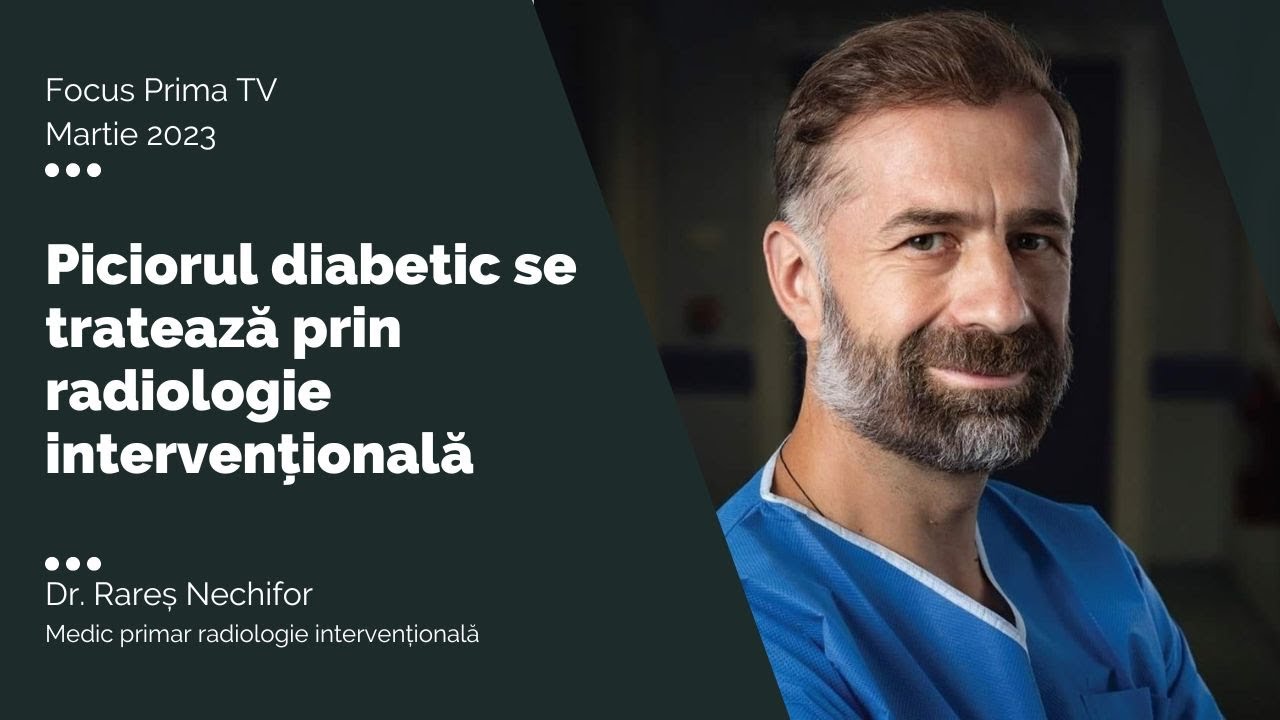 Piciorul diabetic se tratează I Dr. Rareș Nechifor
