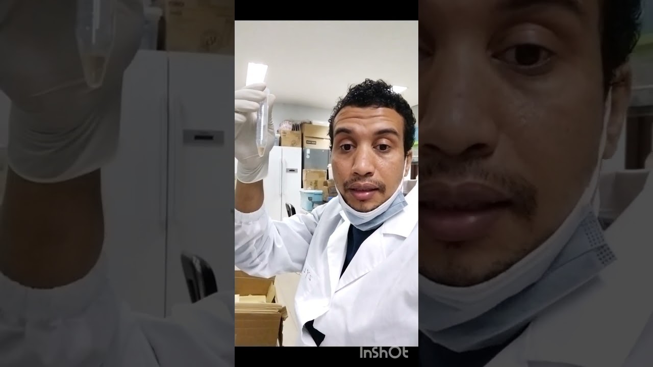 تقدير نسبة السكريات في أي عينة نباتية  determination of carbohydrates by anthrone reagent method