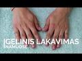 Gelinis lakavimas namuose / ilgalaikio lakavimo eiga