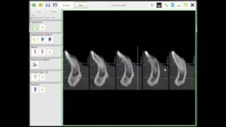AxisGuide®: How to use measuring tools