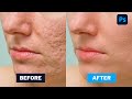 High end Skin Retouching Photoshop Tutorial - Creative Graphic Tv