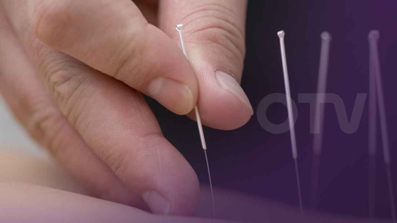 الاقلاع عن التدخين من خلال الوخز بالابر الصينية مع دكتور اوريلي دكاش -