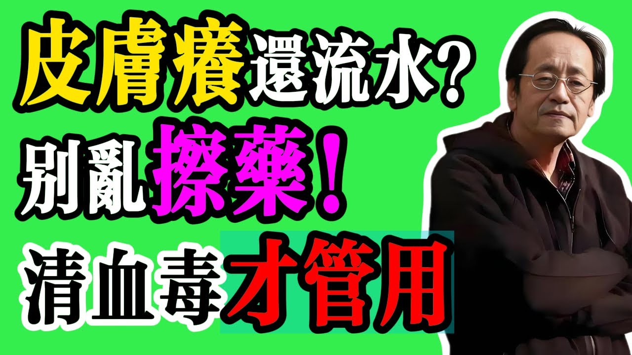 倪海厦：身體這3處「流水」，是濕毒「氾濫」了！千萬別亂擦藥！一招清血毒，從根源止癢。#倪海廈 #中醫養生 #科普 #脾胃