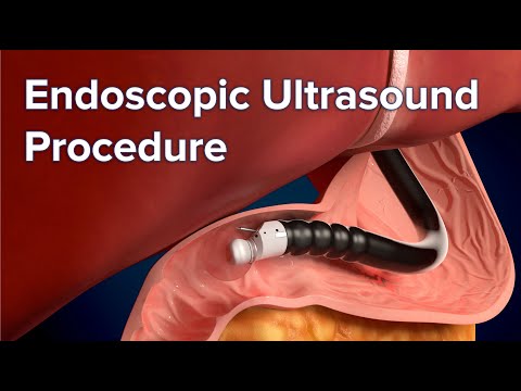 Endoscopic
