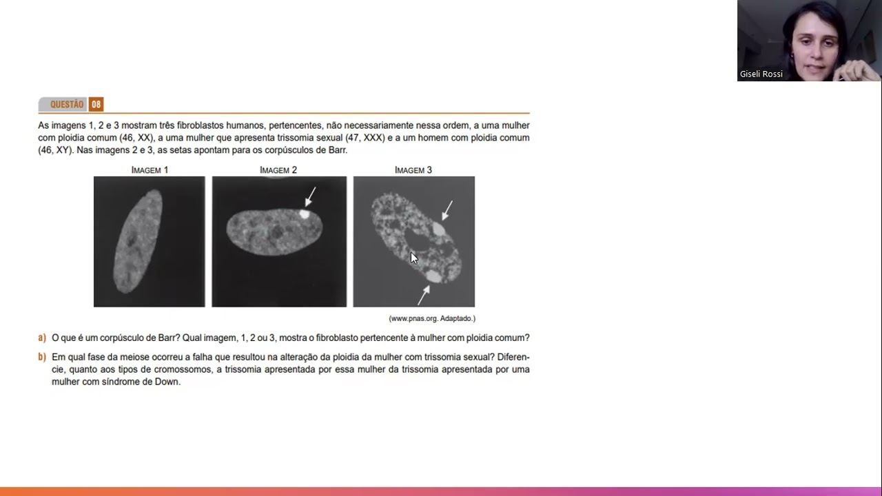 FAMERP-2025-Corpúsculo de Barr