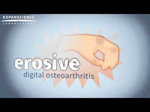 Erosive digital osteoarthritis