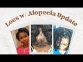 2 yrs 7 mos Loc Update l Alopecia Update