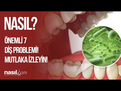 DİKKAT ETMENİZ GEREKEN ÖNEMLİ 7 DİŞ PROBLEMİ! MUTLAKA İZLEYİN!