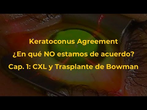 Keratoconus Agreement: En qué NO estamos de acuerdo