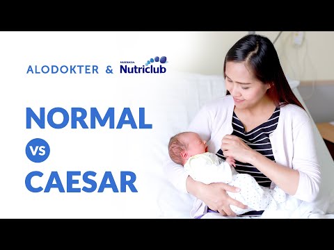 Video: Apakah operasi caesar sakit?