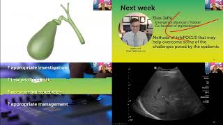 How To Common Bile Duct Ultrasound - Zedu Coaching Corner - Zedu Pocus Coaching Corner June 4