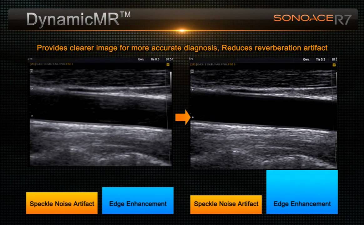 Ecograf 4D Live Doppler Color Sonoace R7