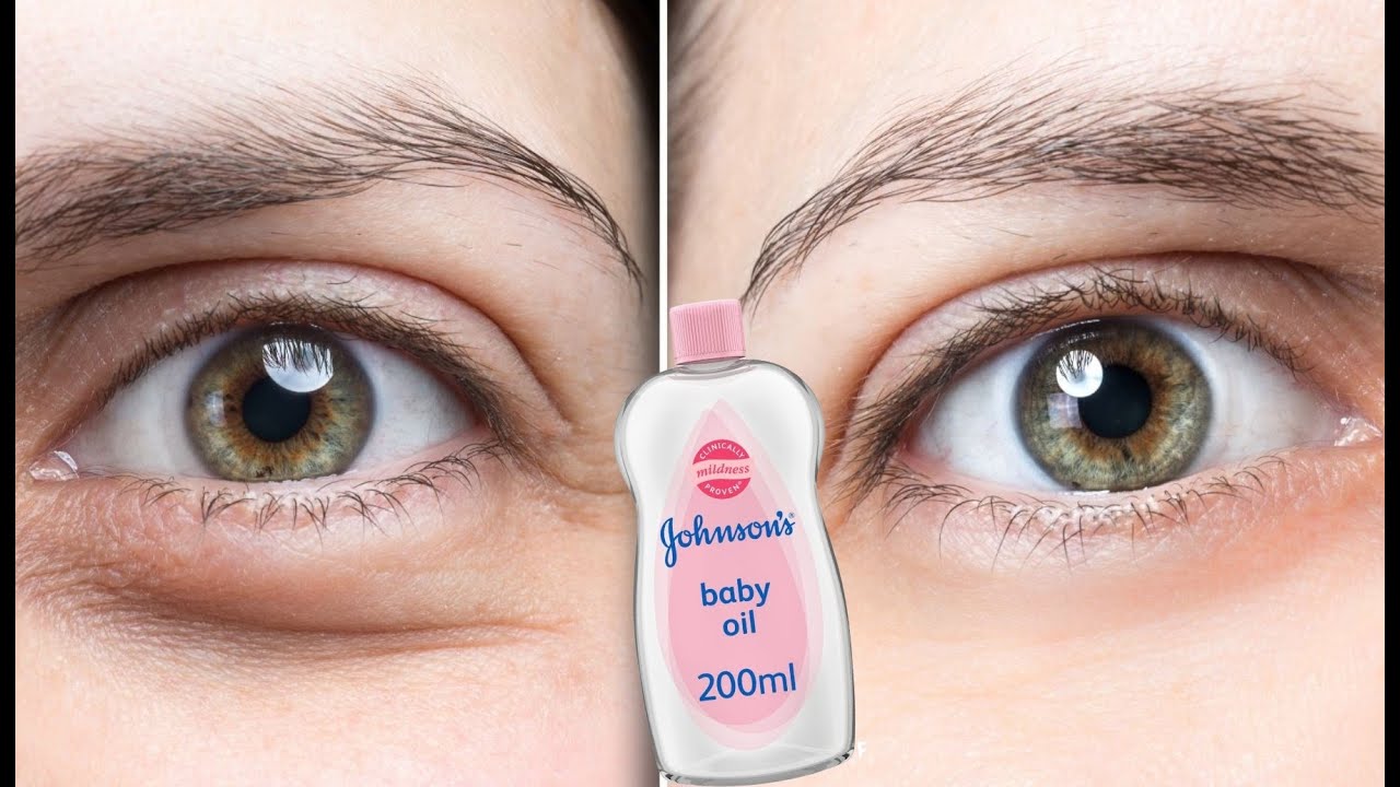 baby oil, remove undereye wrinkles, undereye bags, lines around the eyes and dark circles in1