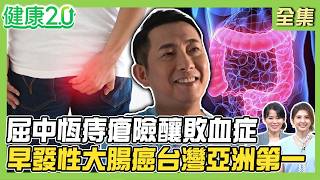 便祕藥年吃掉2.4億顆！屈中恆痔瘡險釀敗血症！內痔、外痔怎麼分？早發性大腸癌暴增 台灣亞洲第一！腫瘤長在這無感致命！健康2.0 20260802【完整版】#陳欣湄#韋汝#許秉毅#柳朋馳#鄒瑋倫#潘瑋翔