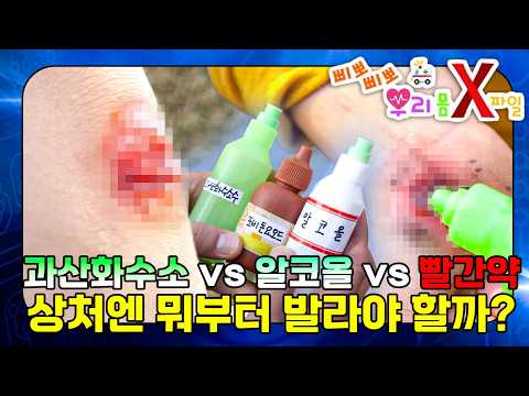 의외로 잘 모르는 상처 소독 상식!｜올바른 소독약 사용법｜우리 몸 X파일｜[EBS놀이터]