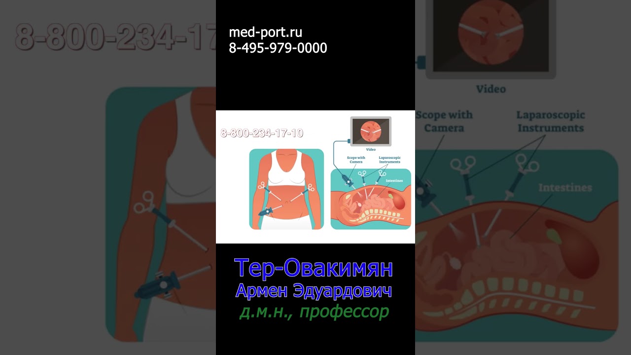 Лапароскопия: что за операция? Плюсы, подготовка