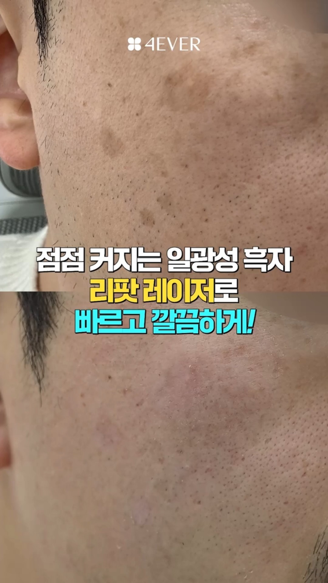 쇼츠