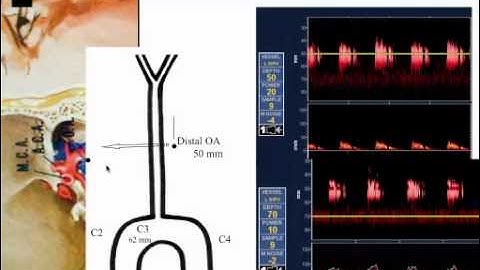 Zsolt3 tcd basics 7152010