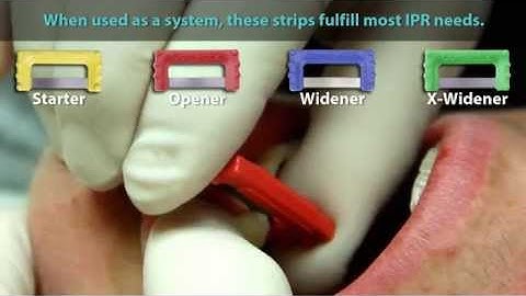 Crowded Teeth - ContacEZ IPR Strip System