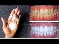 In Just 2 Minutes, Whiten and Shine Your Teeth Like Pearls, 100% Working At Home