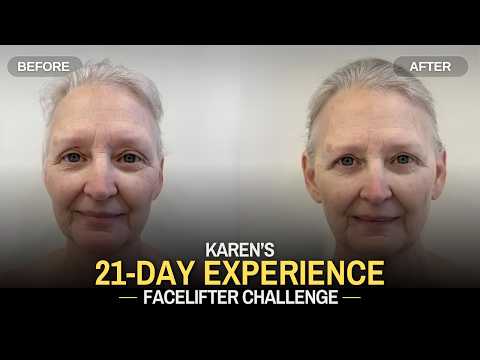 Karen’s 21-Day Facelifter Experience | A Block Therapy Story