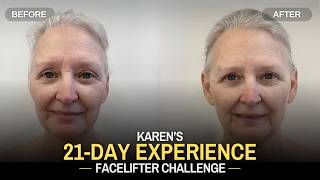 Karen’s 21-Day Facelifter Experience | A Block Therapy Story
