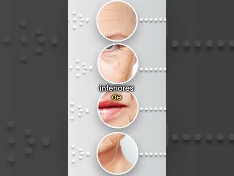 ¿El lifting facial
