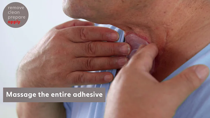 How to use Provox XtraBase