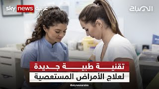 تقنية طبية جديدة ستساعد في علاج الأمراض المستعصية | #الصباح