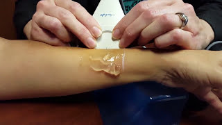MiniOmni bone density scanner - Training 4 - SCAN A PATIENT with MiniOmni bone density scanner